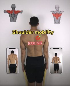 Read more about the article Shoulder Mobility Unlocks Health and Posture